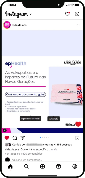 Post da campanha sobre valvopatias no Instagram do @vida.de.acs